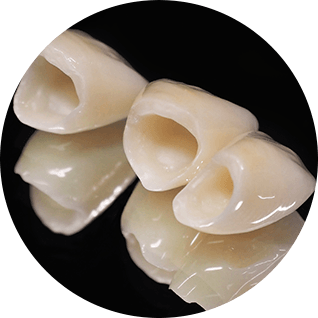 Dental Crowns