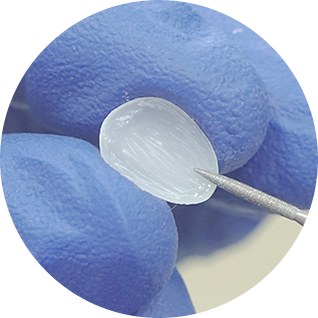 Laminate Veneers