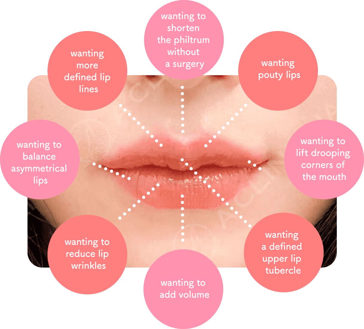 Smile Lip is recommended for those: