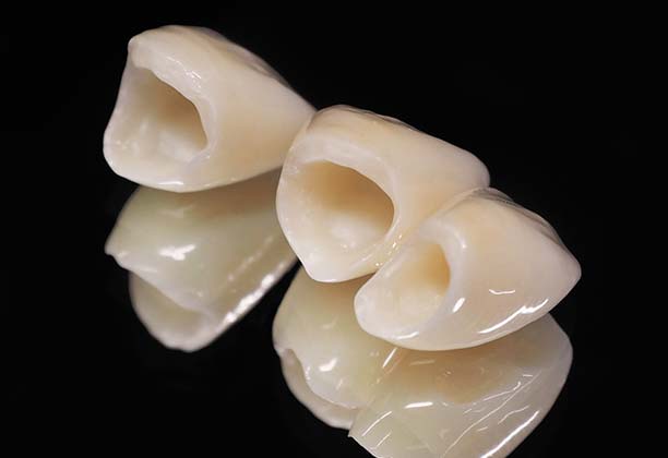 Full Zirconia Crowns (All-Zirconia Crowns)