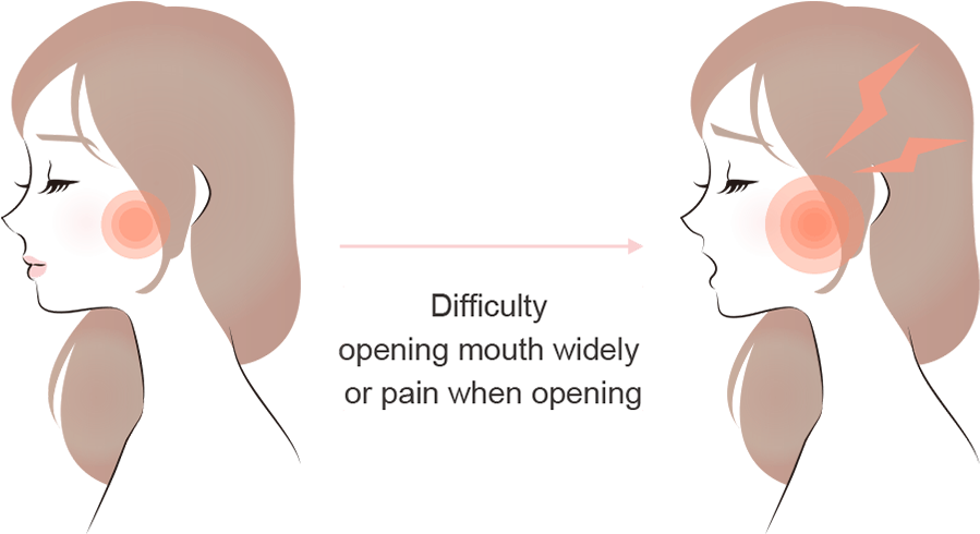 Teeth Grinding & TMJ Treatment