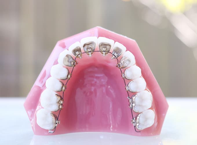 Orthodontics