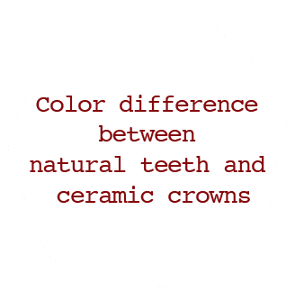 Color difference between natural teeth and ceramic crowns