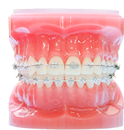 東京銀座の矯正歯科（ワイヤー矯正／マウスピース矯正）「東京銀座A CLINIC デンタル」｜ワイヤー矯正