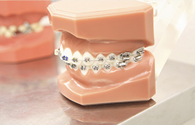 東京銀座の矯正歯科（ワイヤー矯正／マウスピース矯正）「東京銀座A CLINIC デンタル」｜ワイヤー矯正