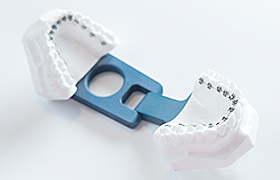 東京銀座の矯正歯科（ワイヤー矯正／マウスピース矯正）「東京銀座A CLINIC デンタル」｜舌側矯正