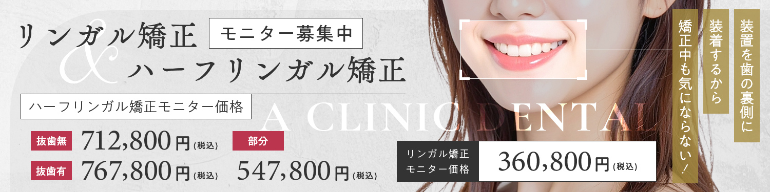 東京銀座の矯正歯科（ワイヤー矯正／マウスピース矯正）「東京銀座A CLINIC デンタル」｜リンガル矯正モニター募集