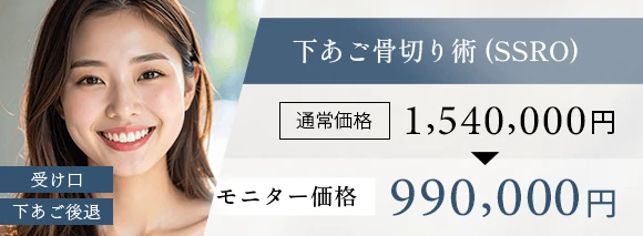東京で骨切りなら「東京銀座A CLINIC デンタル」”下あご骨切り術（SSRO）”