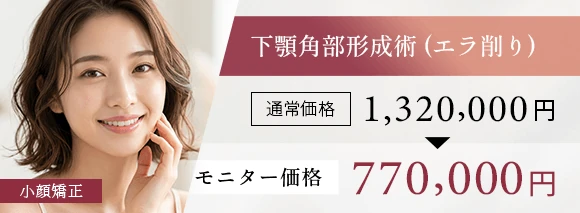 東京で骨切りなら「東京銀座A CLINIC デンタル」”下顎角部形成術（エラ削り）”