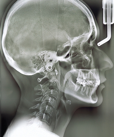 東京銀座の矯正歯科･審美歯科･口腔外科･顎変形症手術専門歯科「東京銀座A CLINIC デンタル」｜セファロ