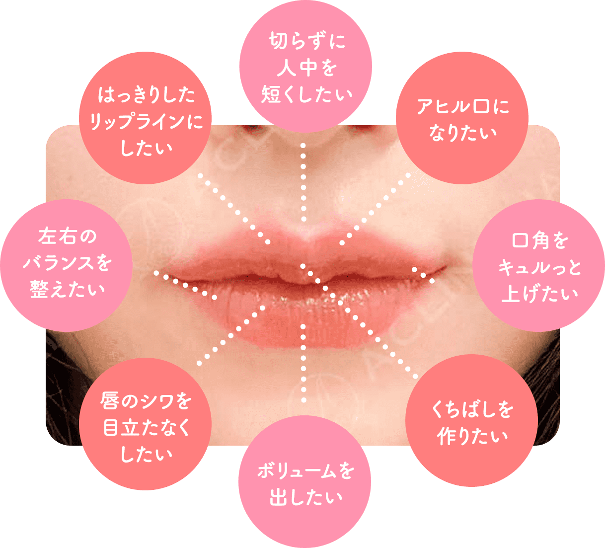 スマイルリップはこんな方におすすめです