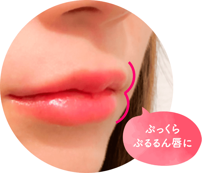 ぷっくらぷるるん唇に