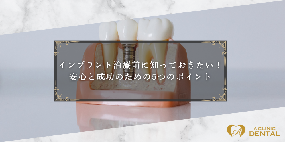 インプラント治療前に知っておきたい！安心と成功のための5つのポイント