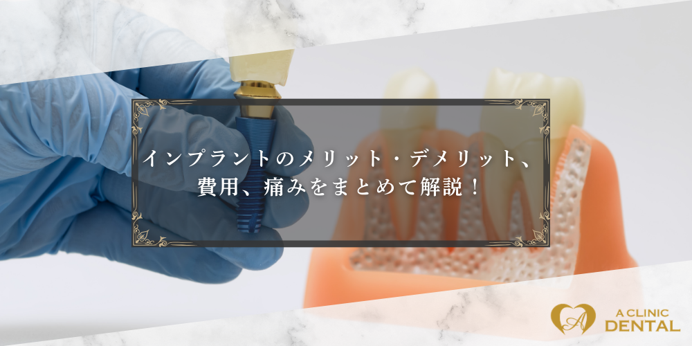 インプラントのメリット・デメリット、費用、痛みをまとめて解説！