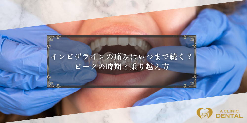 インビザラインの痛みはいつまで続く？ピークの時期と乗り越え方