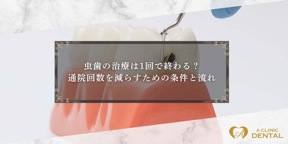虫歯の治療は1回で終わる？通院回数を減らすための条件と流れ