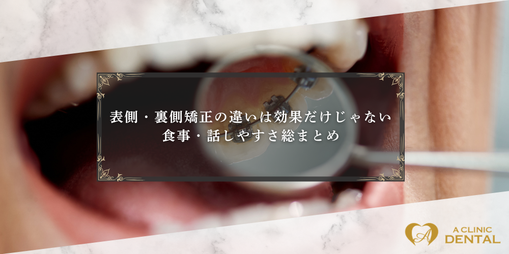 表側・裏側矯正の違いは効果だけじゃない！食事・話しやすさ総まとめ