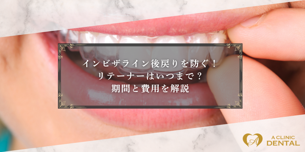インビザライン後戻りを防ぐ！リテーナーはいつまで？期間と費用を解説