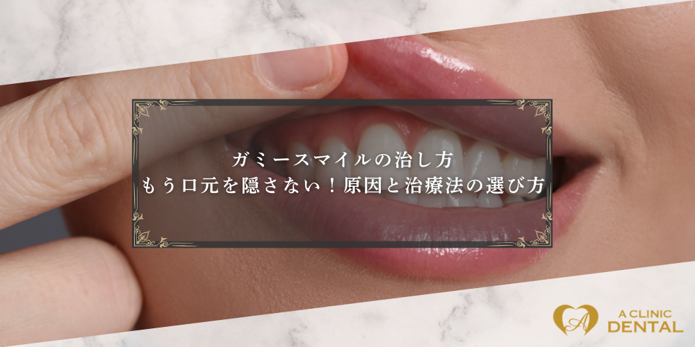ガミースマイルの治し方｜もう口元を隠さない！原因と治療法の選び方