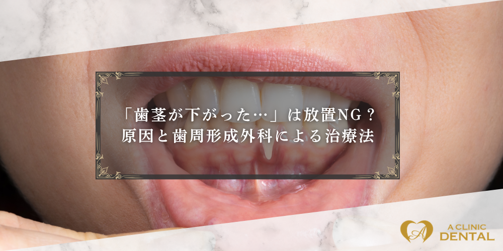 「歯茎が下がった…」は放置NG？原因と歯周形成外科による治療法