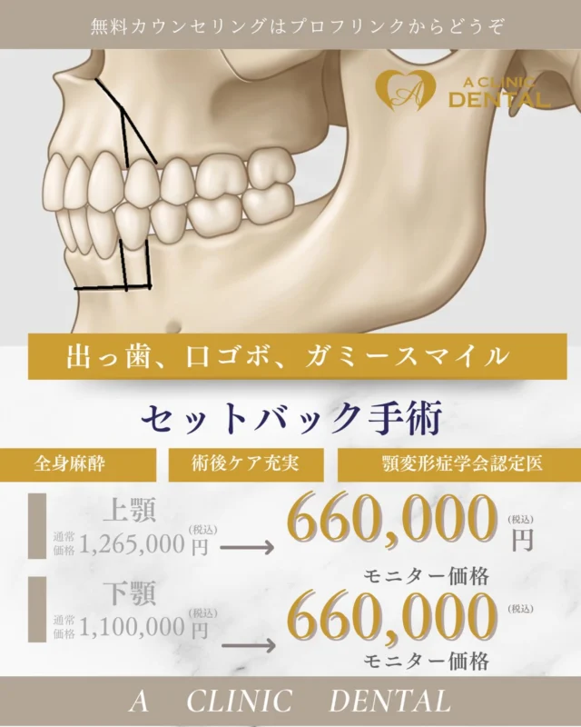 【顎矯正手術・セットバック手術（骨切り）】
メニュー&料金一覧

約50% offの料金でモニター募集をしております。
2026年6月末までのキャンペーンとさせていただき、モニター（症例）が集まり次第、終了とさせていただきます。

大学病院や市中病院で多くの骨切りを執刀した口腔外科学会専門医・顎変形症学会認定医が担当します。
都内クリニックに両資格をもつDr.はたった2名のみ！

この手術は、咬合（噛み合わせ）が深く関与しています。見た目のみならず、機能を改善して長期的な安定をめざすことが重要であり、咬合を知る口腔外科専門医が行うということを重視しています。
なぜならば、見た目が改善されても、噛み合わせが悪いことによって後戻りをしたり、食事がとりづらくなったという方が多々いらっしゃるからです。

また安さを求めて、渡韓される患者様も多いですが、術後管理の問題や言語の問題もあり、不安に思われてる方もいるかと思います。それらの不安も当院では包括的に解消することができます。

【骨切り（顎矯正手術）　無料カウンセリング】
無料カウンセリングではCT・パノラマX線写真撮影、口腔内写真撮影、顔貌写真撮影をさせていただき、的確な診査診断のもと、ご本人の理想に近づける治療方針を一緒に練っていければと思います。
相談程度にも、お気軽にお越しください。

予約はプロフリンクより、お願い申し上げます。

あなたの口元の美の追求をお手伝いさせてください。

#骨切り #セットバック手術 #セットバック #口ゴボ #横顔美人