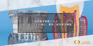自家歯牙移植とは？インプラントとの違い、費用、成功率を解説